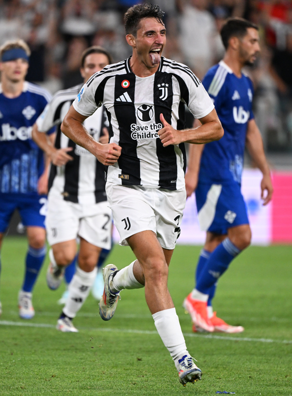 肾上腺素 肾上腺素